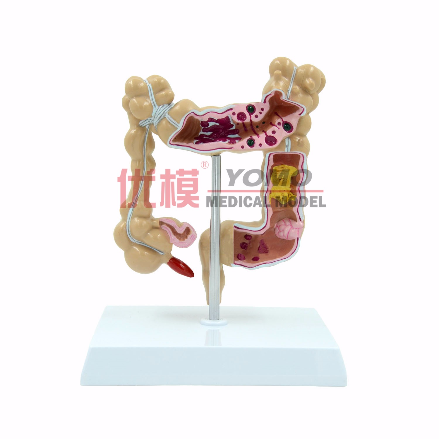 結(jié)腸病理模型